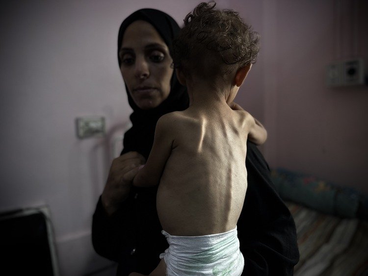 Gazze’de can kaybı 62 bini geçti: Açlıktan ölümler artıyor