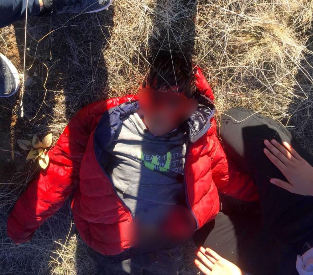 Köpek Saldırısına Uğrayan Çocuk Yoğun Bakıma Alındı