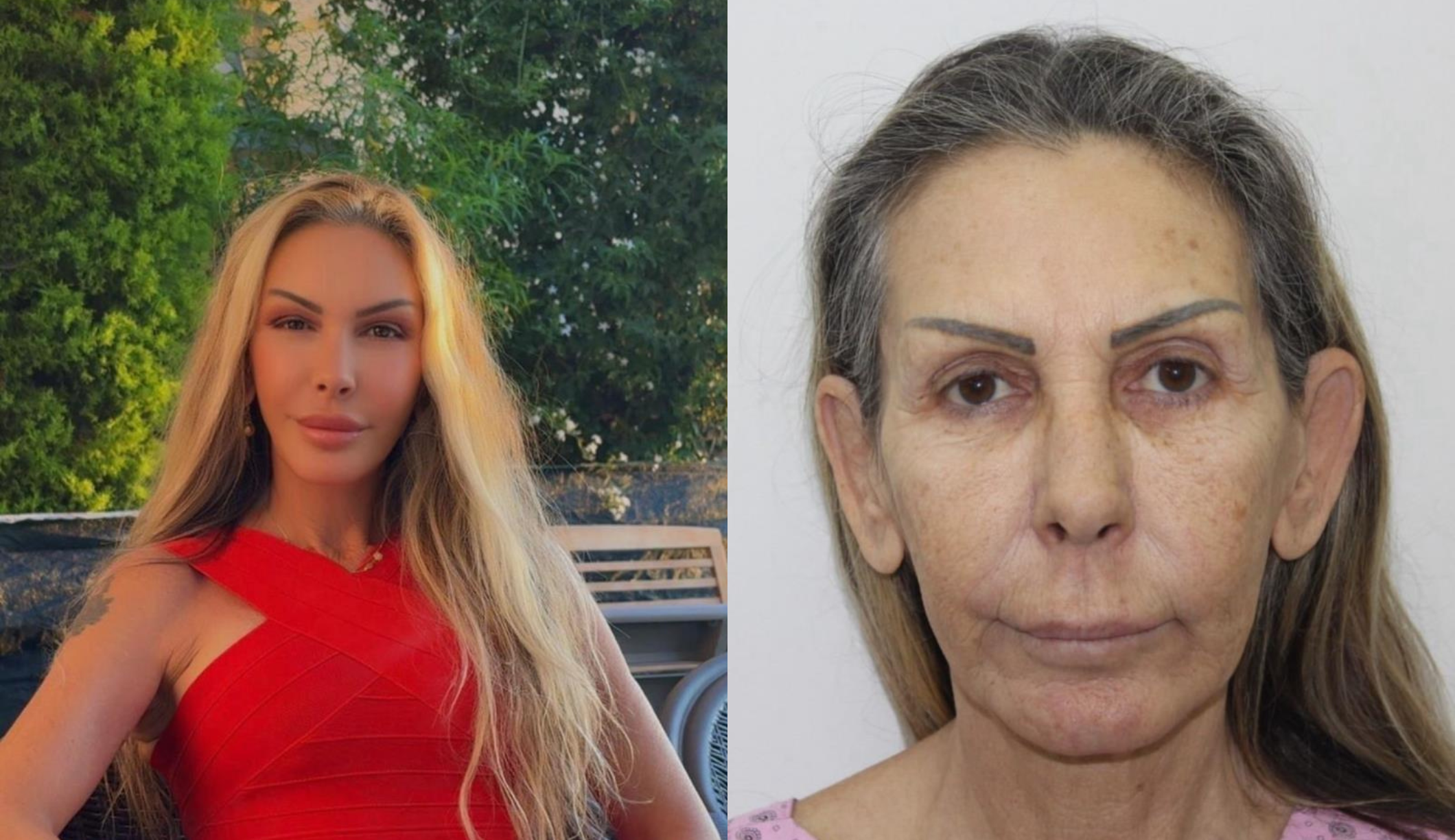 Petek Dinçöz'den sonra annesi de estetik ameliyat oldu - Manşet Haber