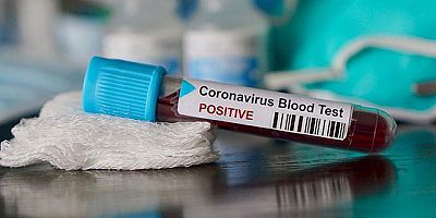 Koronavirüs salgınında bir belirti daha ortaya çıktı