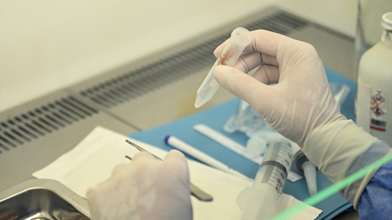 2 ila 5 yıl saklanıyor: Türkiye’nin tek deri bankası büyüyor