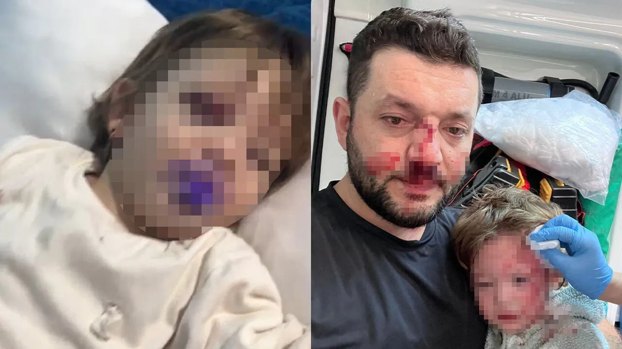 Yalova’da 14 aylık kızın babası darbedildi, sanık tahliye edildi