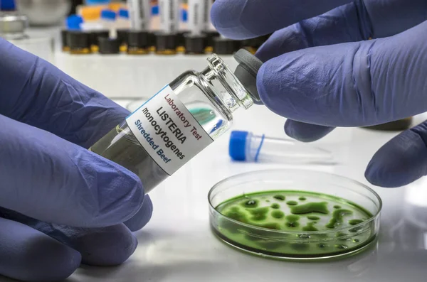 Tahsildaroğlu peynirinde Listeria bakterisi tespit edildi: Toplatma kararı verildi