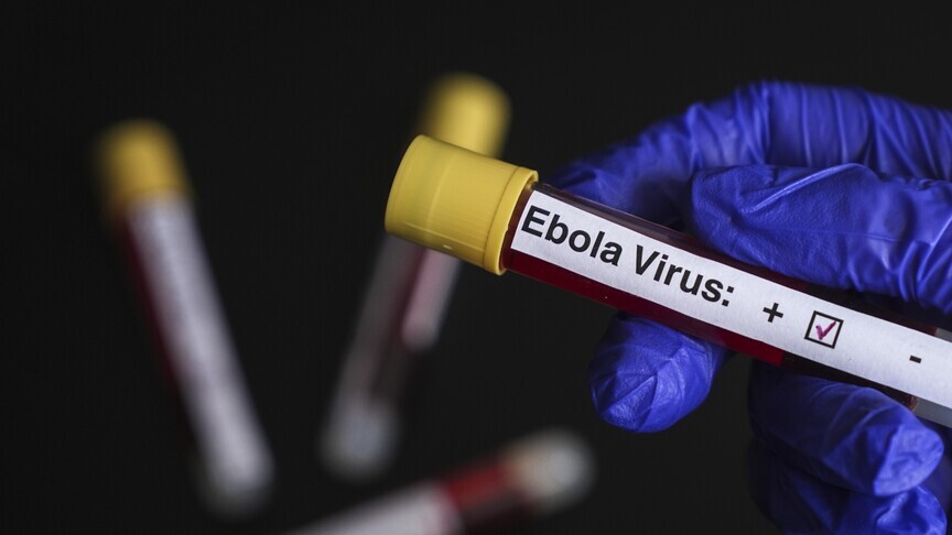 KDC'deki Ebola salgını 2 bin 325 can aldı