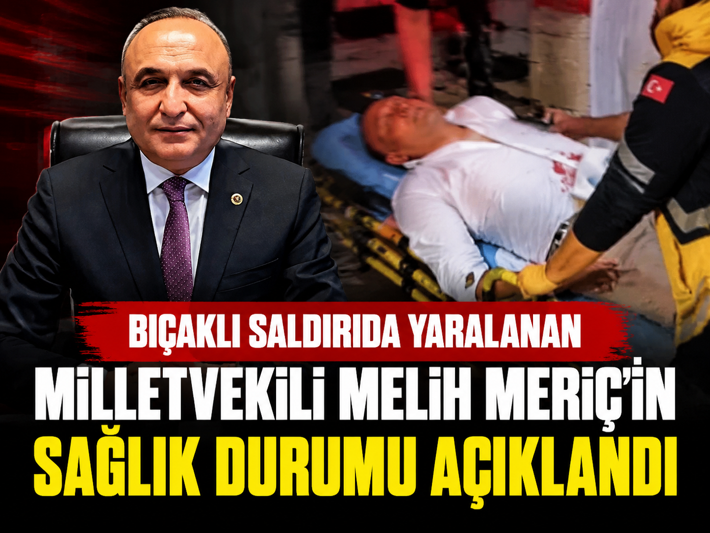 Bıçaklı saldırıda yaralanan Milletvekili Melih Meriç’in sağlık durumu açıklandı