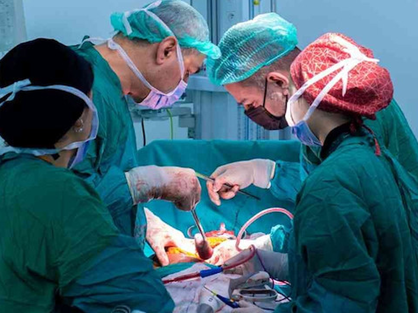 Karnı 9 aylık hamile gibi şişti: 12,8 kiloluk kitle çıktı