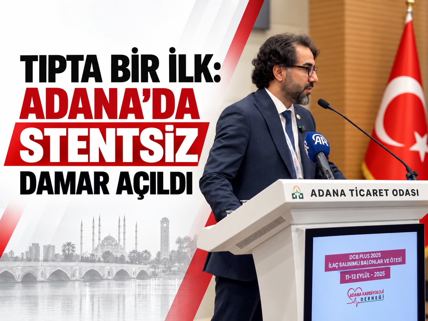 Tıpta bir ilk: Adana’da stentsiz damar açıldı