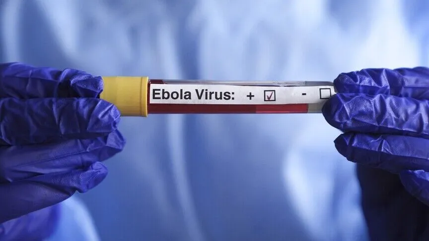 Demokratik Kongo'da Ebola alarmı: Vaka sayısı 7 bin 672'ye çıktı